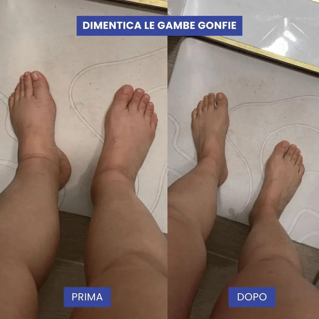Gambe e piedi sgonfi con pelle più uniforme